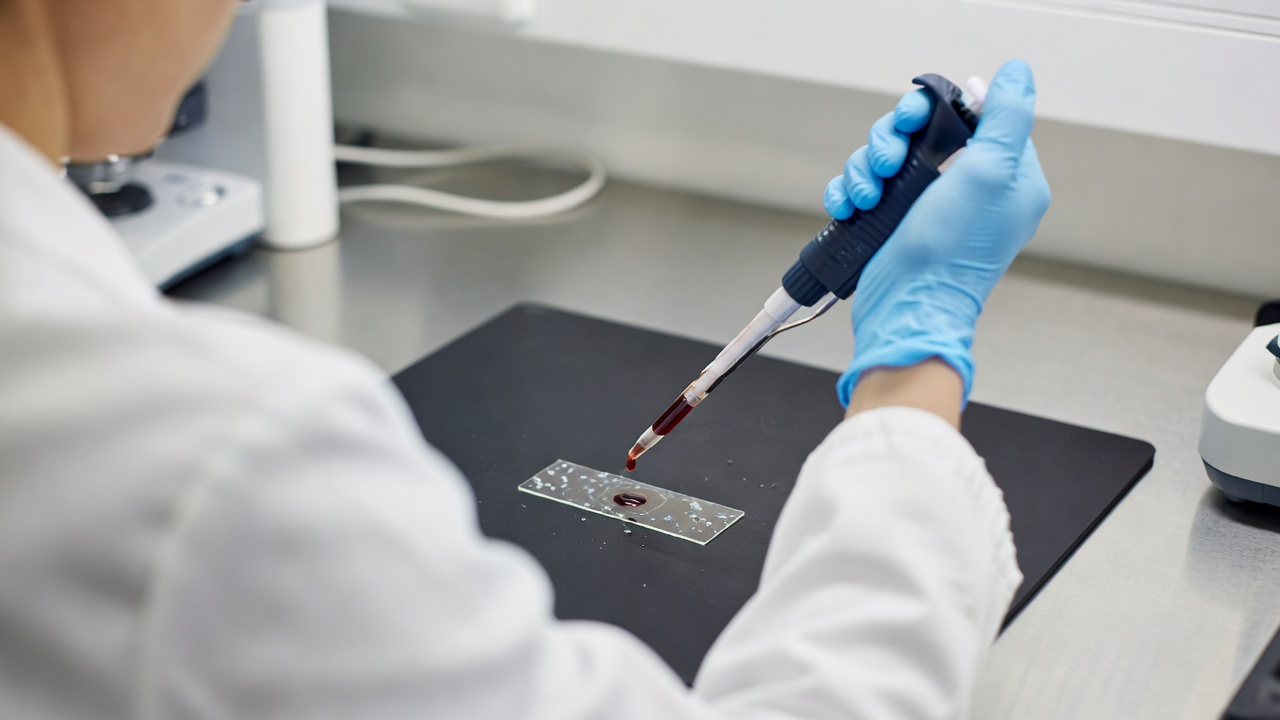Over-the-shoulder medium shot of a lab technician pipetting dark red serum onto a glass microscope slide prepared for electron microscopy analysis of microplastic particles, bright high-key daylight from overhead LED panels, 50mm lens, f/4.